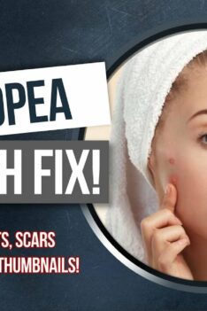 How To Remove Blemishes & Acne From Images (Gaming Thumbnails) for FREE – Photopea Tutorial